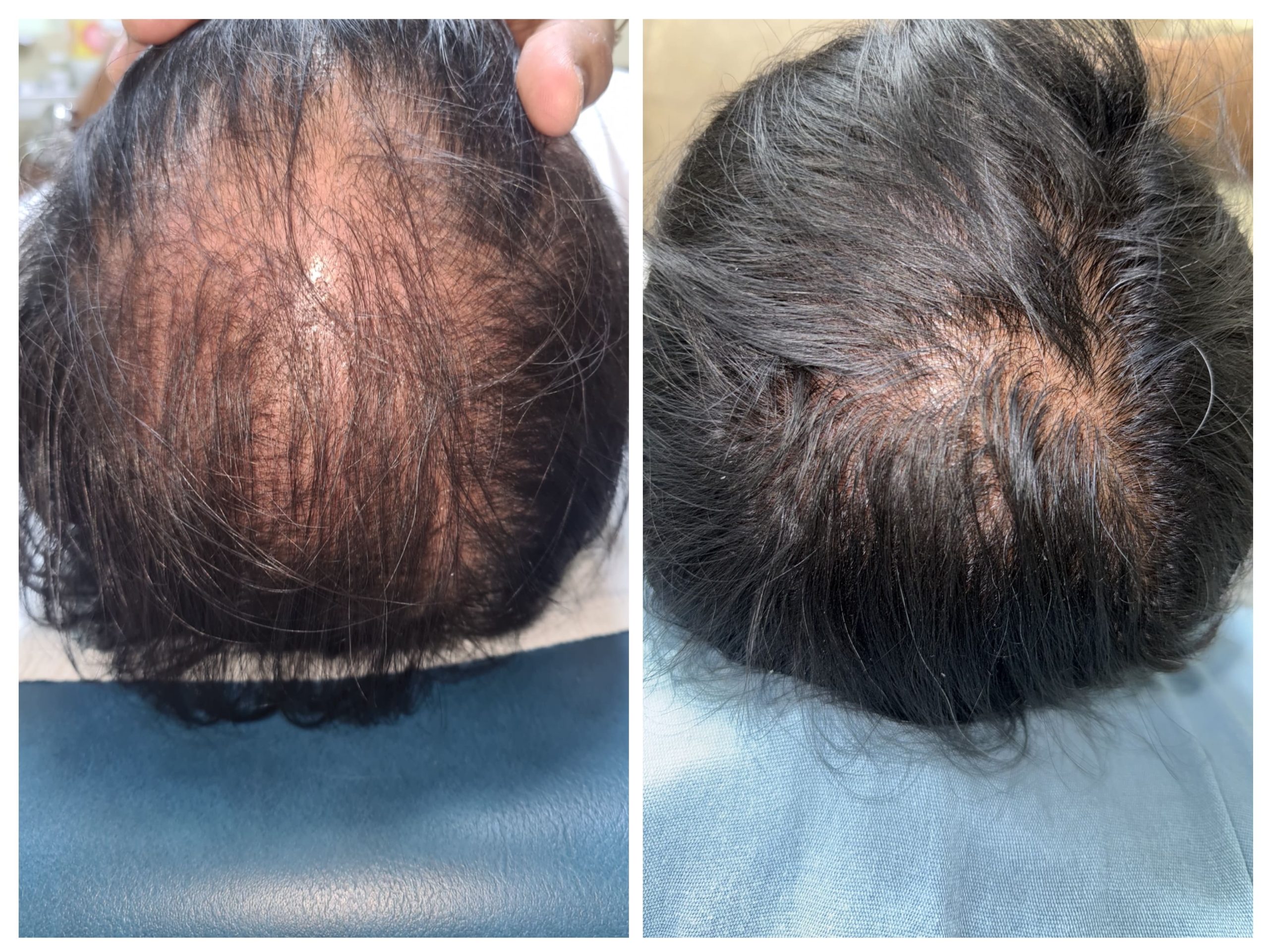 ANTES Y DESPUES